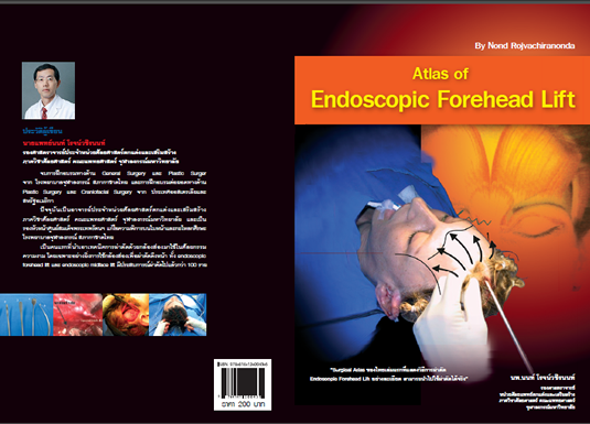Dr. Nond's textbook - Atlas of Endoscopic Forehead Lift