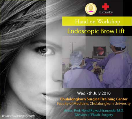 Hands-on Workshop on Endoscopic Forehead Lift